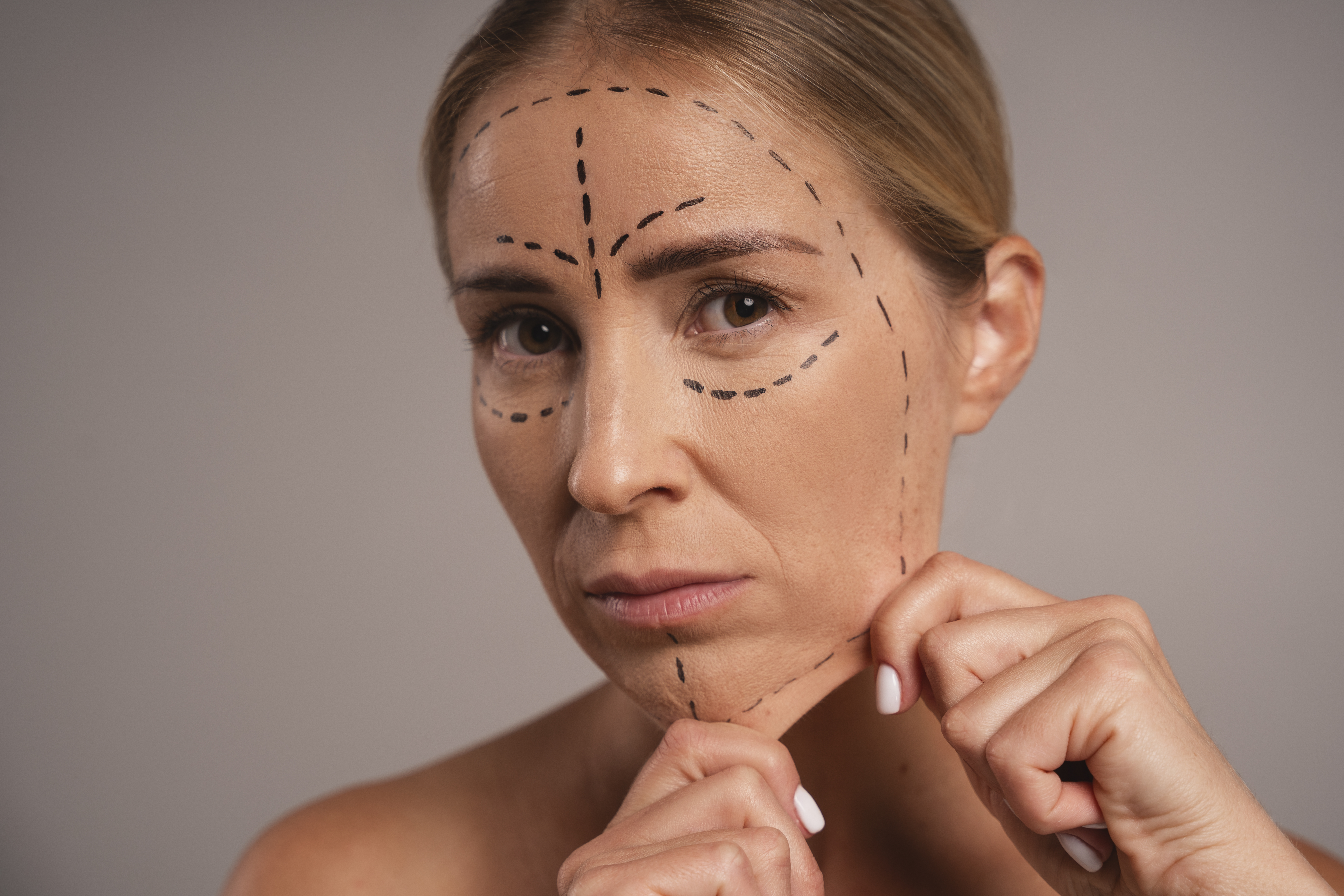 8 Reasons People Are Choosing Deep Line Reduction Treatments in London Over Surgery