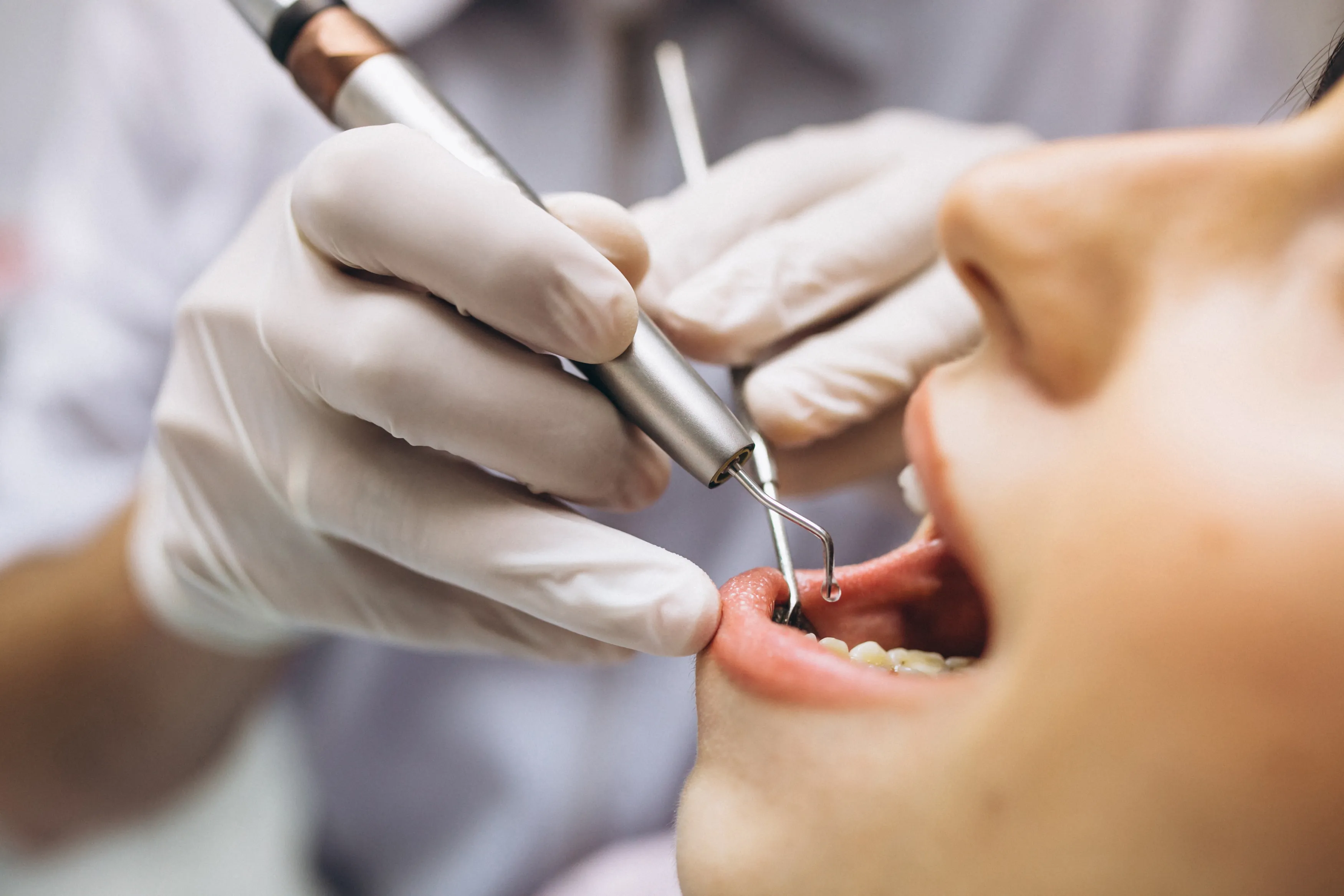 5 Things Your Dentist Wishes You Knew